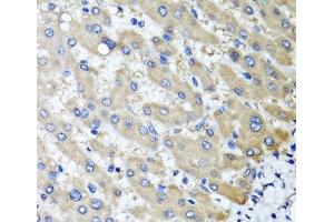 Immunohistochemistry of paraffin-embedded Human liver damage using RBP2 Polyclonal Antibody at dilution of 1:100 (40x lens).