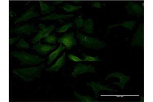 Immunofluorescence of monoclonal antibody to IL15 on HeLa cell. (IL-15 antibody  (AA 49-162))