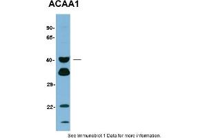 Sample Type: Human LiverPrimary Dilution: 1:1000Gel concentration: 12% (ACAA1 antibody  (N-Term))