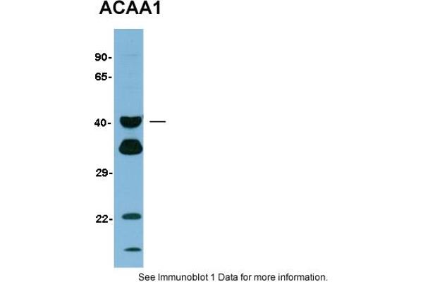ACAA1 antibody  (N-Term)