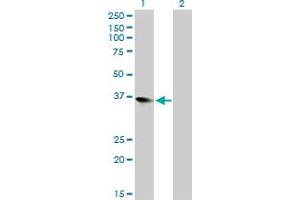 Western Blot analysis of ZFP36L1 expression in transfected 293T cell line by ZFP36L1 monoclonal antibody (M02), clone 1A3. (ZFP36L1 antibody  (AA 1-108))