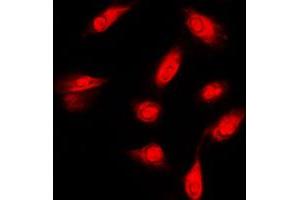 Immunofluorescent analysis of c-FER staining in HeLa cells. (FER antibody  (C-Term))