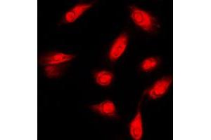 Immunofluorescent analysis of c-FER staining in HeLa cells. (FER antibody  (C-Term))