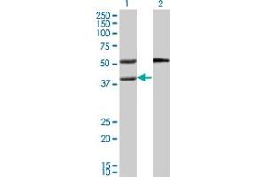 Western Blotting (WB) image for anti-Mevalonate Kinase (MVK) (AA 297-397) antibody (ABIN599406) (MVK antibody  (AA 297-397))