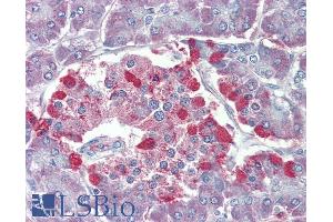 ABIN6391352 (3. (TRPM2 antibody  (Internal Region))