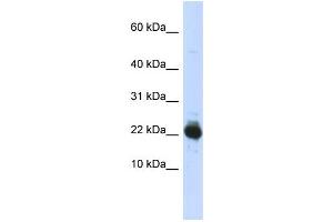 WB Suggested Anti-UBE2L3 Antibody Titration:  0. (UBE2L3 antibody  (Middle Region))
