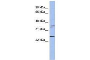 Image no. 1 for anti-Necdin Homolog (Mouse) (NDN) (AA 179-228) antibody (ABIN6744060)