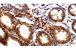 Immunohistochemistry (IHC) image for anti-Epithelial Cell Adhesion Molecule (EPCAM) (AA 25-265) antibody (ABIN7443065)