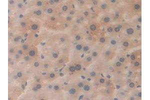 DAB staining on IHC-P; Samples: Mouse Liver Tissue (APP antibody  (AA 672-711))