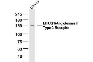 Mouse uterus lysates probed with MTUS1 Polyclonal Antibody, unconjugated  at 1:300 overnight at 4°C followed by a conjugated secondary antibody for 60 minutes at 37°C.
