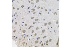Immunohistochemistry of paraffin-embedded rat brain using VEPH1 antibody (ABIN5974616) (40x lens). (VEPH1 antibody)