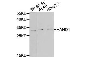 Western blot analysis of extracts of various cells, using HAND1 antibody. (HAND1 antibody)