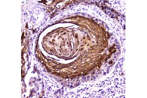 IHC analysis of FABP5 using anti-FABP5 antibody . (FABP5 antibody)