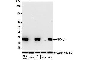Western Blotting (WB) image for anti-Ubiquitin Carboxyl-terminal Esterase L1 (Ubiquitin Thiolesterase) (UCHL1) (AA 50-100) antibody (ABIN7449527) (Recombinant UCHL1 antibody  (AA 50-100))