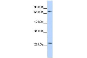 Western Blot showing ZNF185 antibody used at a concentration of 1-2 ug/ml to detect its target protein.