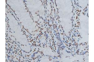 ABIN6267039 at 1/200 staining human colon tissue sections by IHC-P. (Histone 3 antibody)