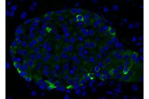 Immunohistochemistry (IHC) image for anti-Chromogranin B (Secretogranin 1) (CHGB) (AA 407-677) antibody (ABIN1742518) (CHGB antibody  (AA 407-677))