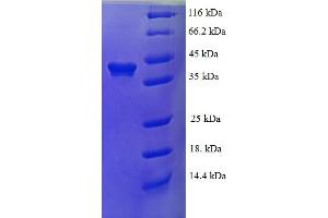 SDS-PAGE (SDS) image for RNA Binding Motif Protein 9 (RBM9) (AA 1-380) protein (His tag) (ABIN5710222)