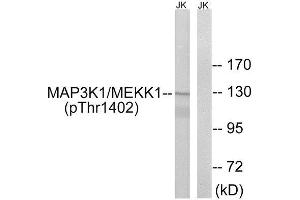 Western Blotting (WB) image for anti-Mitogen-Activated Protein Kinase Kinase Kinase 1 (MAP3K1) (pThr1402) antibody (ABIN1847609) (MAP3K1 antibody  (pThr1402))