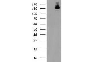 Western Blotting (WB) image for anti-Histone Deacetylase 6 (HDAC6) antibody (ABIN1498618) (HDAC6 antibody)