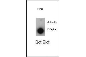 Dot blot analysis of anti-Phospho-P21CIP1-T57 Antibody (ABIN389613 and ABIN2839617) on nitrocellulose membrane. (p21 antibody  (pThr57))