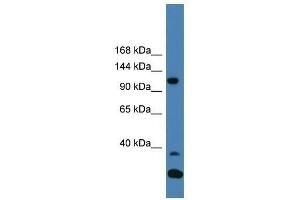 Western Blot showing TYK2 antibody used at a concentration of 1-2 ug/ml to detect its target protein. (TYK2 antibody  (C-Term))