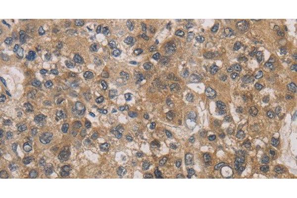 DEGS1 antibody
