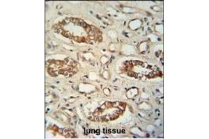 M1L antibody (C-term) (ABIN654954 and ABIN2844594) immunohistochemistry analysis in formalin fixed and paraffin embedded human lung tissue followed by peroxidase conjugation of the secondary antibody and DAB staining.