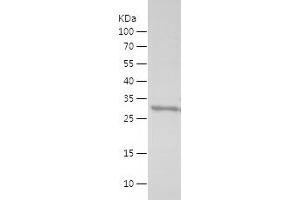 Western Blotting (WB) image for Fused in Sarcoma (FUS) (AA 287-376) protein (His-IF2DI Tag) (ABIN7283041) (FUS Protein (AA 287-376) (His-IF2DI Tag))