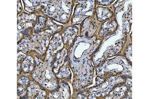 IHC analysis of Annexin A10/ANXA10 using anti-Annexin A10/ANXA10 antibody (ABIN7601853).