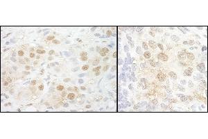 anti-Nuclear Cap Binding Protein Subunit 2 (NCBP2) (AA 106-156) antibody