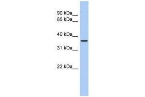 Aquaporin 10 antibody used at 1 ug/ml to detect target protein. (Aquaporin 10 antibody  (Middle Region))
