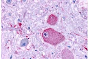Anti-GPR37 antibody  ABIN1048808 IHC staining of human brain, neurons and glia.
