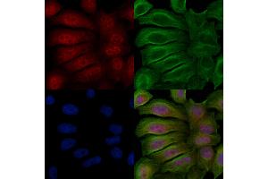 ABIN6256394 and ABIN6267617 staining Hela cells(20 min of 30uM Forskolin treatment) by IF/ICC. (PKC delta antibody  (pSer645))
