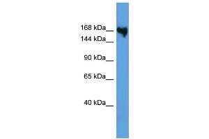 WB Suggested Anti-COL5A1 Antibody Titration: 0. (COL5A1 antibody  (N-Term))