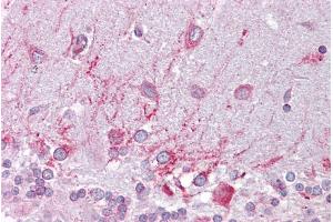 Immunohistochemistry with Brain, cerebellum tissue at an antibody concentration of 5µg/ml using anti-PSEN1 antibody (ARP44201_P050) (Presenilin 1 antibody  (N-Term))