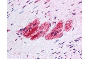 SEPN1 antibody was used for immunohistochemistry at a concentration of 4-8 ug/ml. (SEPN1 antibody  (C-Term))