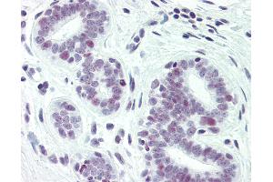 Anti-PAX2 antibody IHC of human breast. (PAX2A antibody  (pSer393))