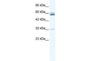 WB Suggested Anti-ZNF491 Antibody Titration:  0.
