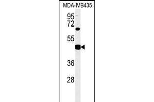 SH2D2A Antibody (Center) (ABIN651523 and ABIN2840277) western blot analysis in MDA-M cell line lysates (35 μg/lane). (SH2D2A antibody  (AA 86-112))