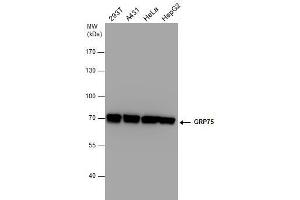WB Image GRP75 antibody detects GRP75 protein by western blot analysis. (HSPA9 antibody  (Center))