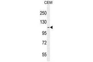 AT8B2 Antibody (N-term) western blot analysis in CEM cell line lysates (35µg/lane). (ATP8B2 antibody  (N-Term))