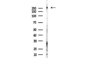 Western blot analysis of lysates from Hela cells(starvation 24h treatment), using KCC2 Antibody at 1/1000 dilution.