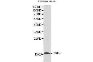 Western Blotting (WB) image for anti-Lysozyme-Like 6 (LYZL6) (AA 20-148) antibody (ABIN3021348) (LYZL6 antibody  (AA 20-148))