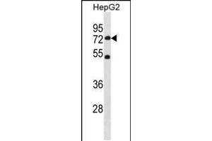 Western blot analysis in HepG2 cell line lysates (35ug/lane). (SETD3 antibody  (C-Term))