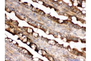 Immunohistochemistry (IHC) image for anti-Isocitrate Dehydrogenase 2 (NADP+), Mitochondrial (IDH2) (AA 413-447), (C-Term) antibody (ABIN3043856)