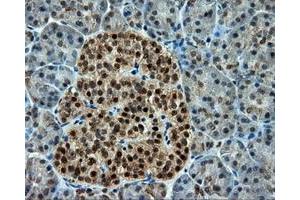 Immunohistochemical staining of paraffin-embedded Kidney tissue using anti-CUGBP1 mouse monoclonal antibody.