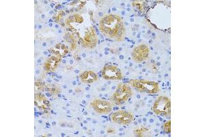 Immunohistochemistry of paraffin-embedded rat kidney using FDPS Antibody (ABIN5973369) at dilution of 1/100 (40x lens).