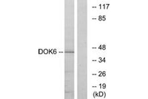 Western blot analysis of extracts from COLO cells, using DOK6 Antibody. (DOK6 antibody  (AA 111-160))