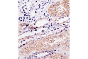 Immunohistochemical analysis of paraffin-embedded H. (PPP2R2A antibody  (N-Term))
